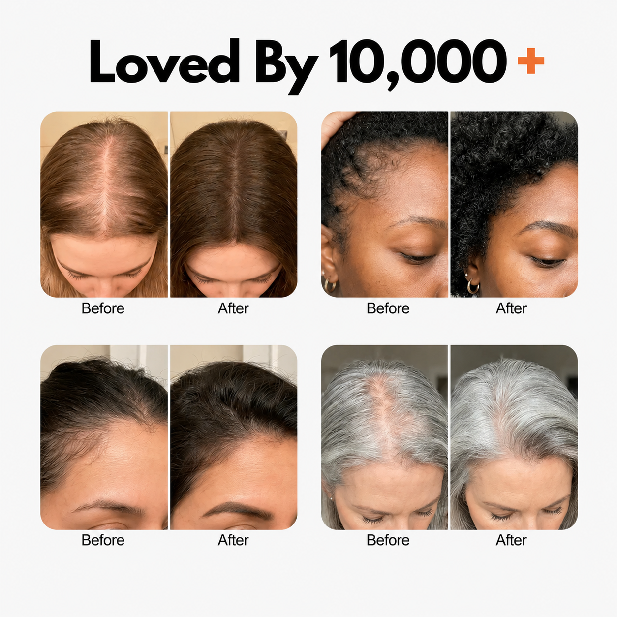 GrowLabs® -  Korea’s #1 Hair Growth Serum