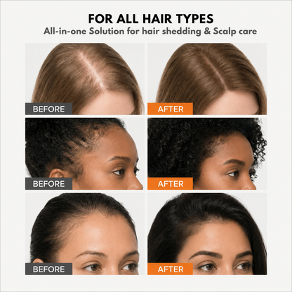 GrowLabs® -  Korea’s #1 Hair Growth Serum